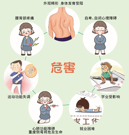 影響的不僅僅是形體,當(dāng)心脊柱側(cè)彎毀一生!